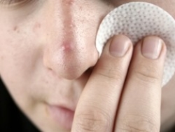 FDA警告：祛痘产品可能导致生命危险
